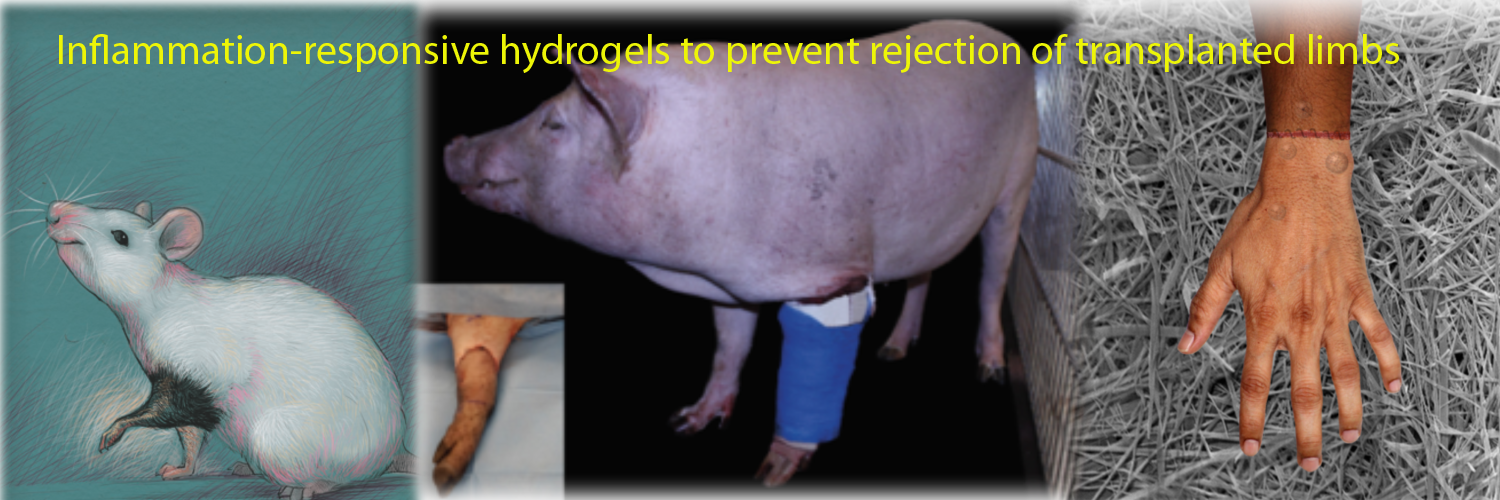 Inflammation-responsive hydrogels